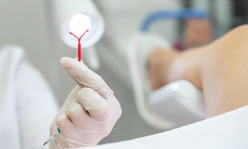 Governo de Goiás realiza mutirão de DIU para ampliar acesso ao planejamento reprodutivo